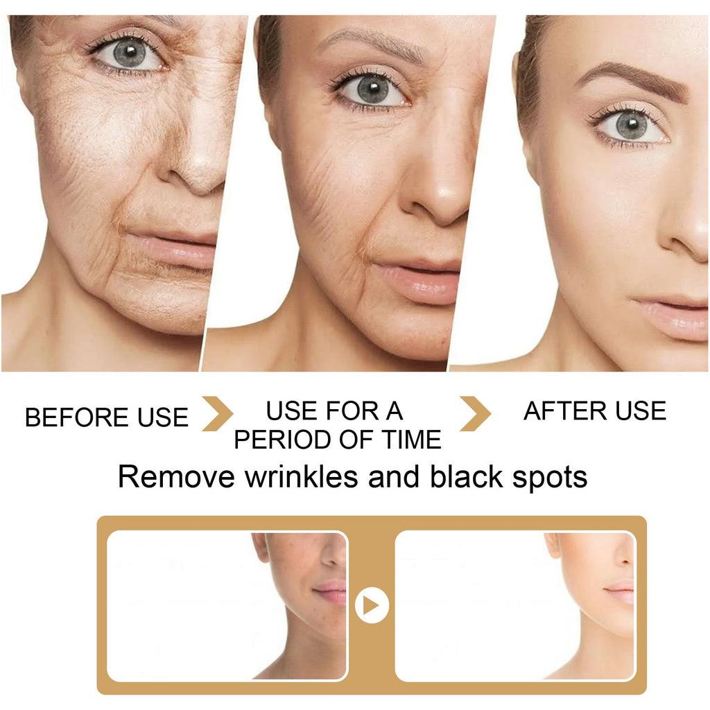 EELHOE Turmeric Dark Spot Correction Face Care Spot Moisturizing And